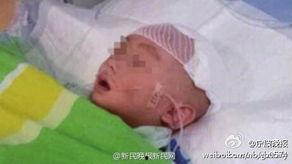 开颅手术吃蜜瓜,创新营养补给新篇章