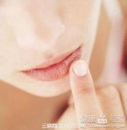 唇炎可以吃瓜吗,瓜类食物的适宜与禁忌